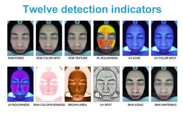 3D Scope Skin Scope Analyzer, Skin Analyzer Magnifier Machine With Camera