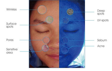 Dla lekarza kosmetycznego Profesjonalna analiza skóry Analizator twarzy Analizator twarzy 3D Magic Mirror Skin Analyzer White CE FDA