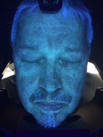 Maszyna do diagnozowania skanera skóry, analiza skóry 3d UV