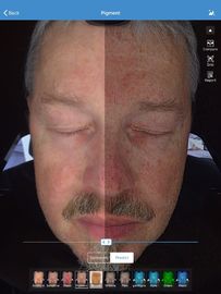 Twarzy 3d Skin Analyzer Scanner Visia 32 gb Storage For Doctor Skin Clinic
