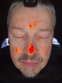 3D Digital Skin Analyzer Magic Mirror Tester do kliniki terapeutycznej