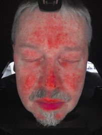 Pielęgnacja urody Cyfrowy analizator wilgoci, tester oleju do kontroli skóry