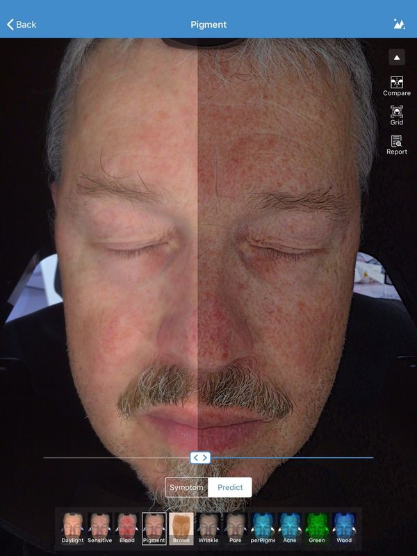 Twarzy 3d Skin Analyzer Scanner Visia 32 gb Storage For Doctor Skin Clinic